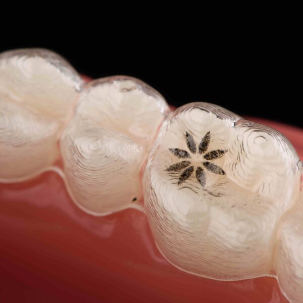 Развенчание мифов об инвизилинге: Развенчание распространенных заблуждений