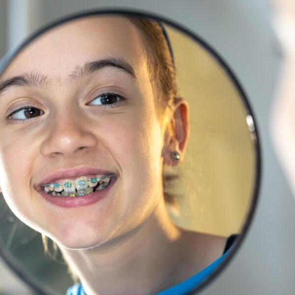 7 Signs You or Your Child Might Need Dental Braces (Beyond Crooked Teeth)
