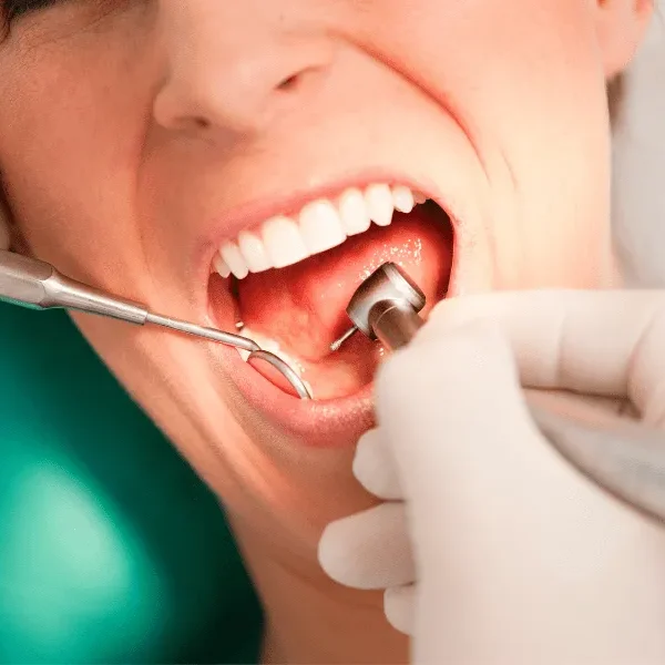 A patient discussing dental implant surgery with a dentist, addressing concerns about pain and recovery.