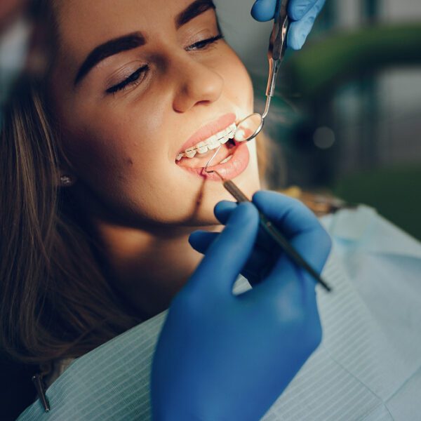 Everything You Need to Know About Braces Treatment for a Perfect Smile