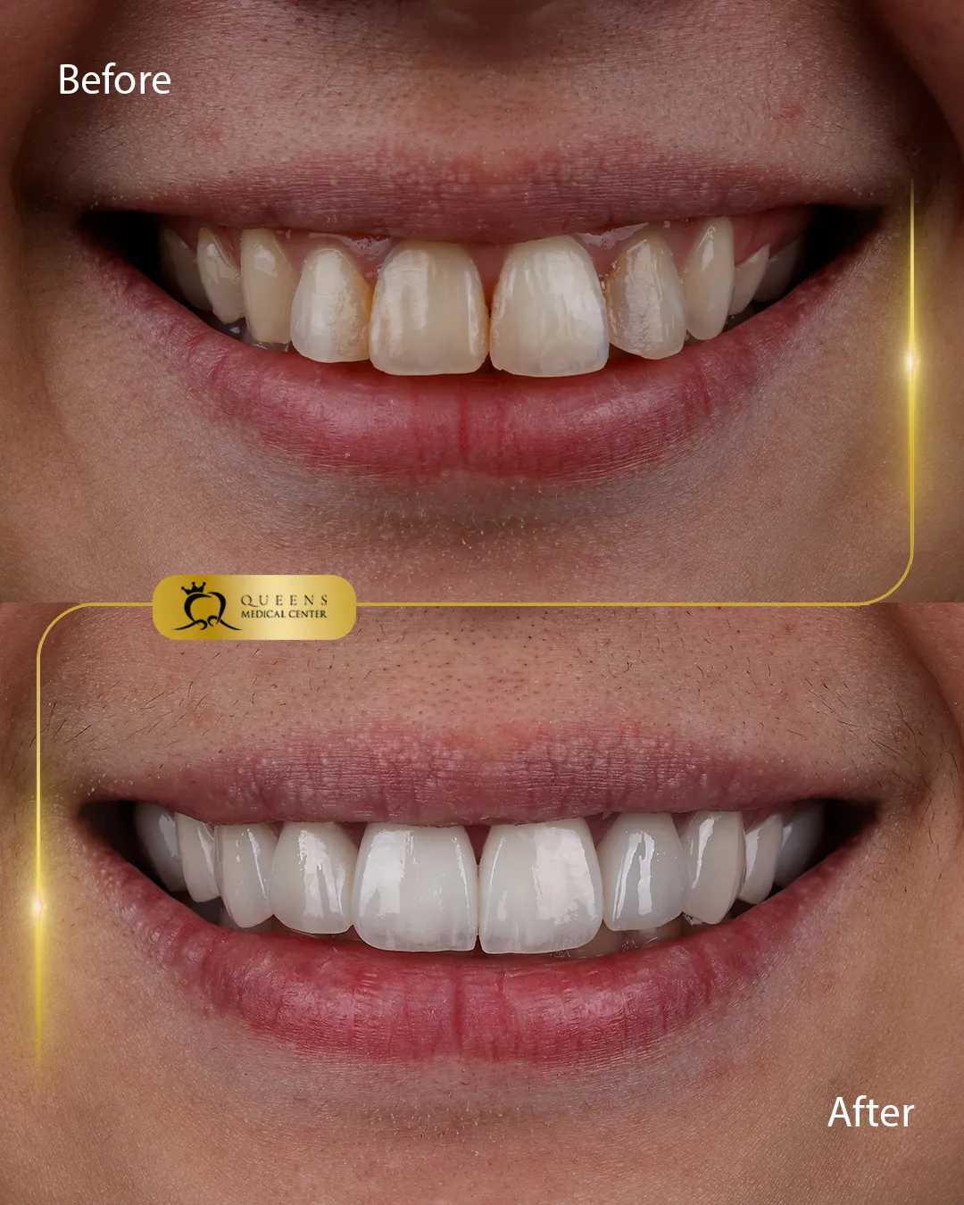 Before and after copy