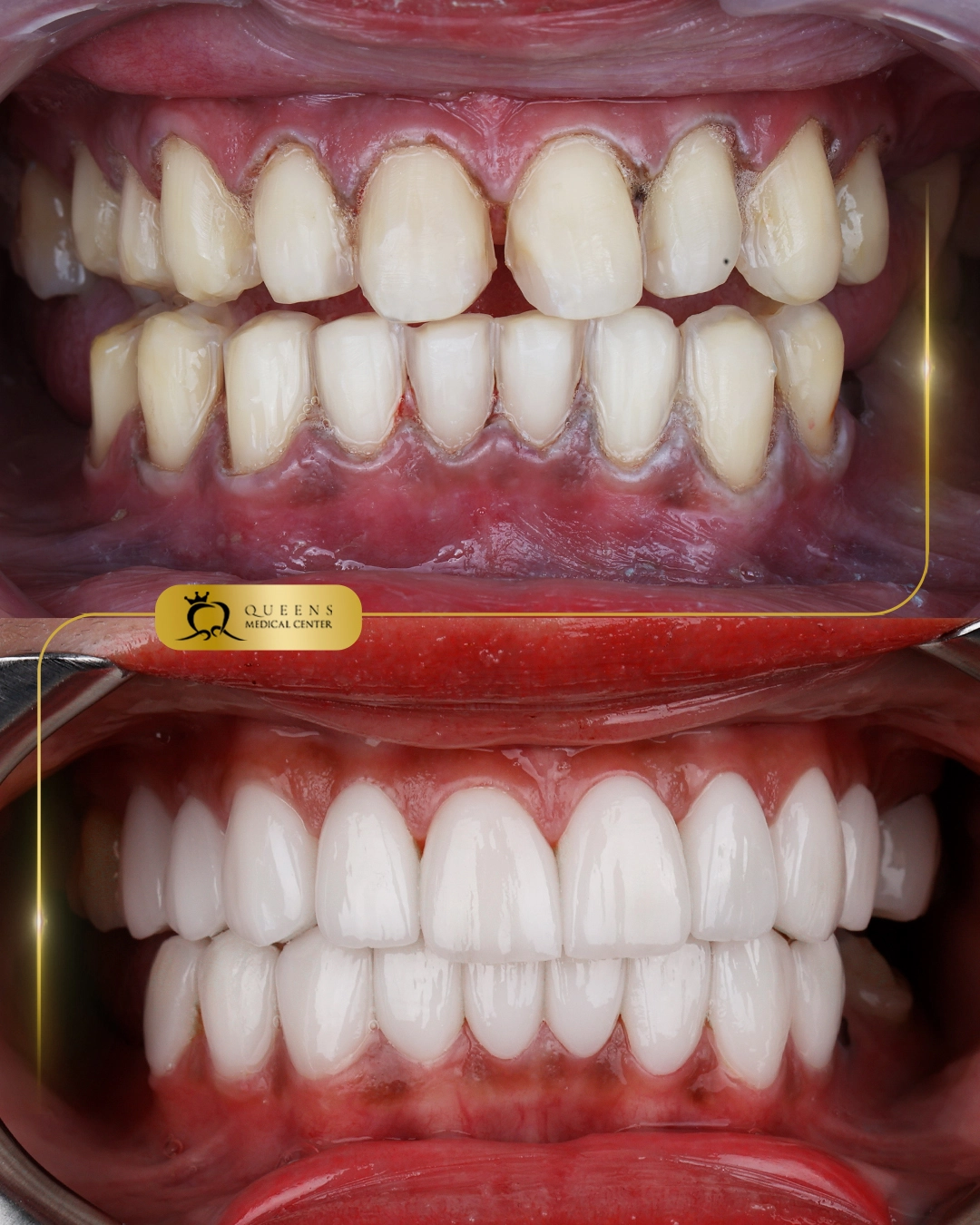 Dr.amer s154730 Jekris alimon quitalig