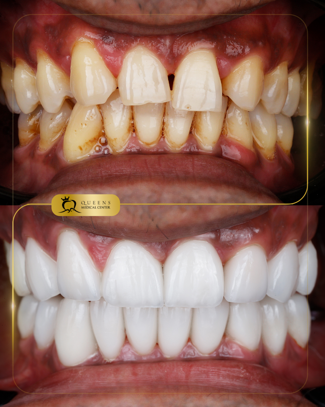 Dr.haroon #S155587 Arnold macapobre.