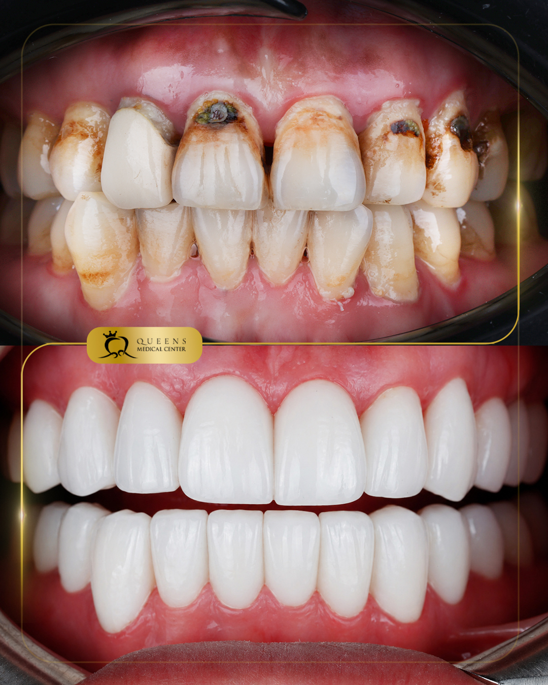 Dr.haroon #s153767 pijie chen