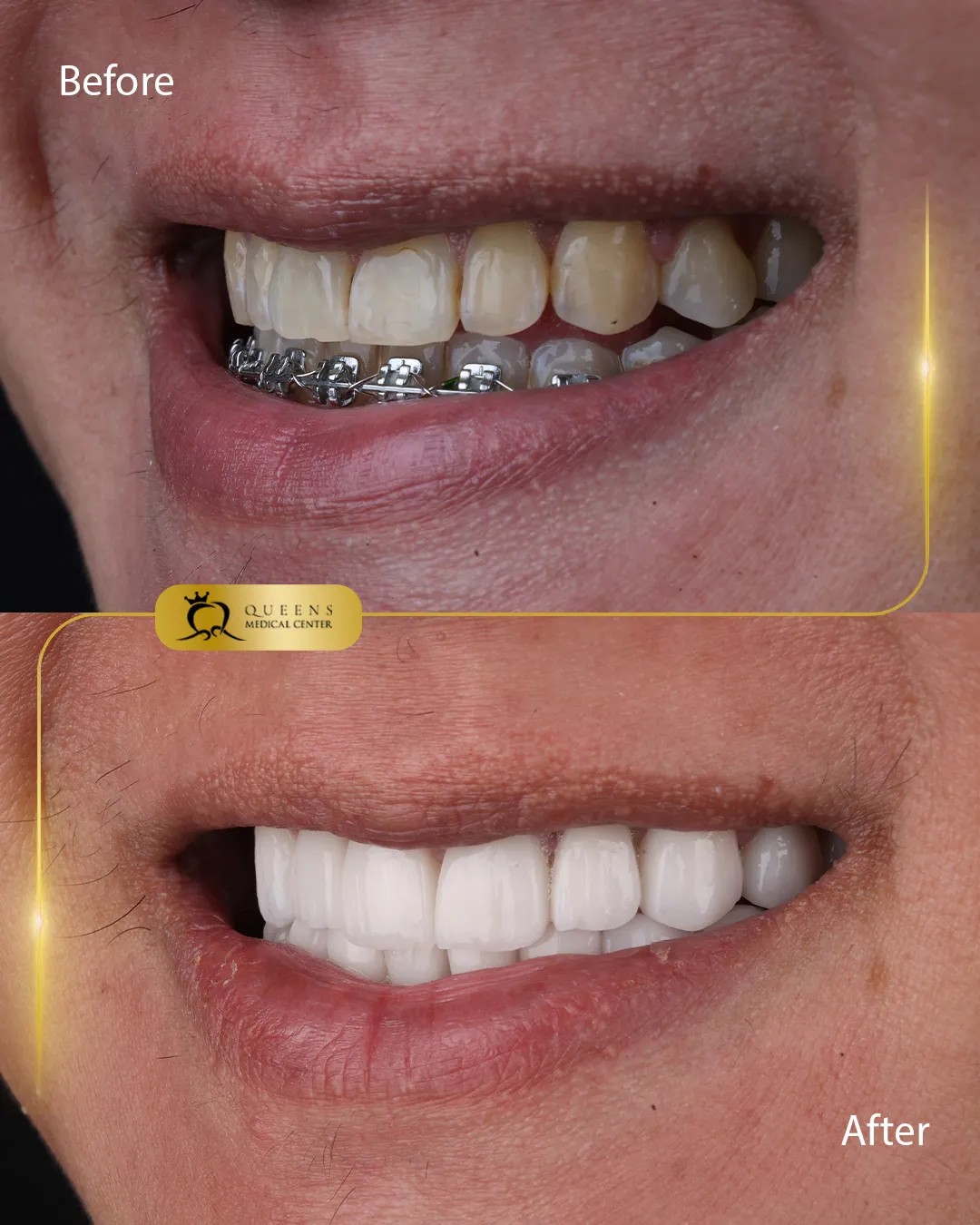 Jonathan Caparas #B27656