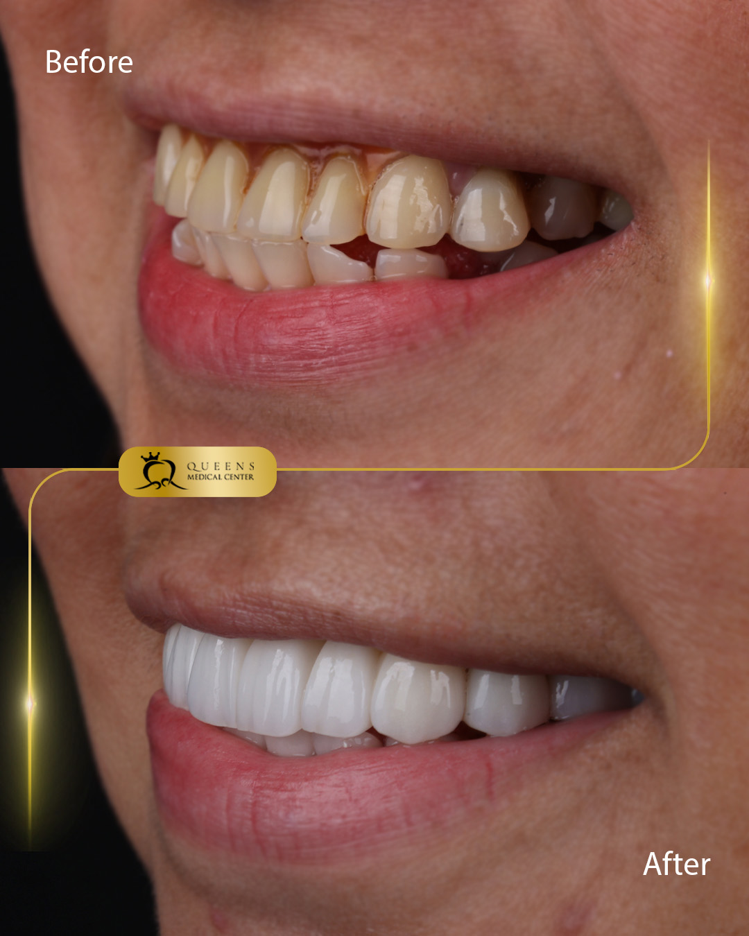 Marie Anne Dablo #R15260
