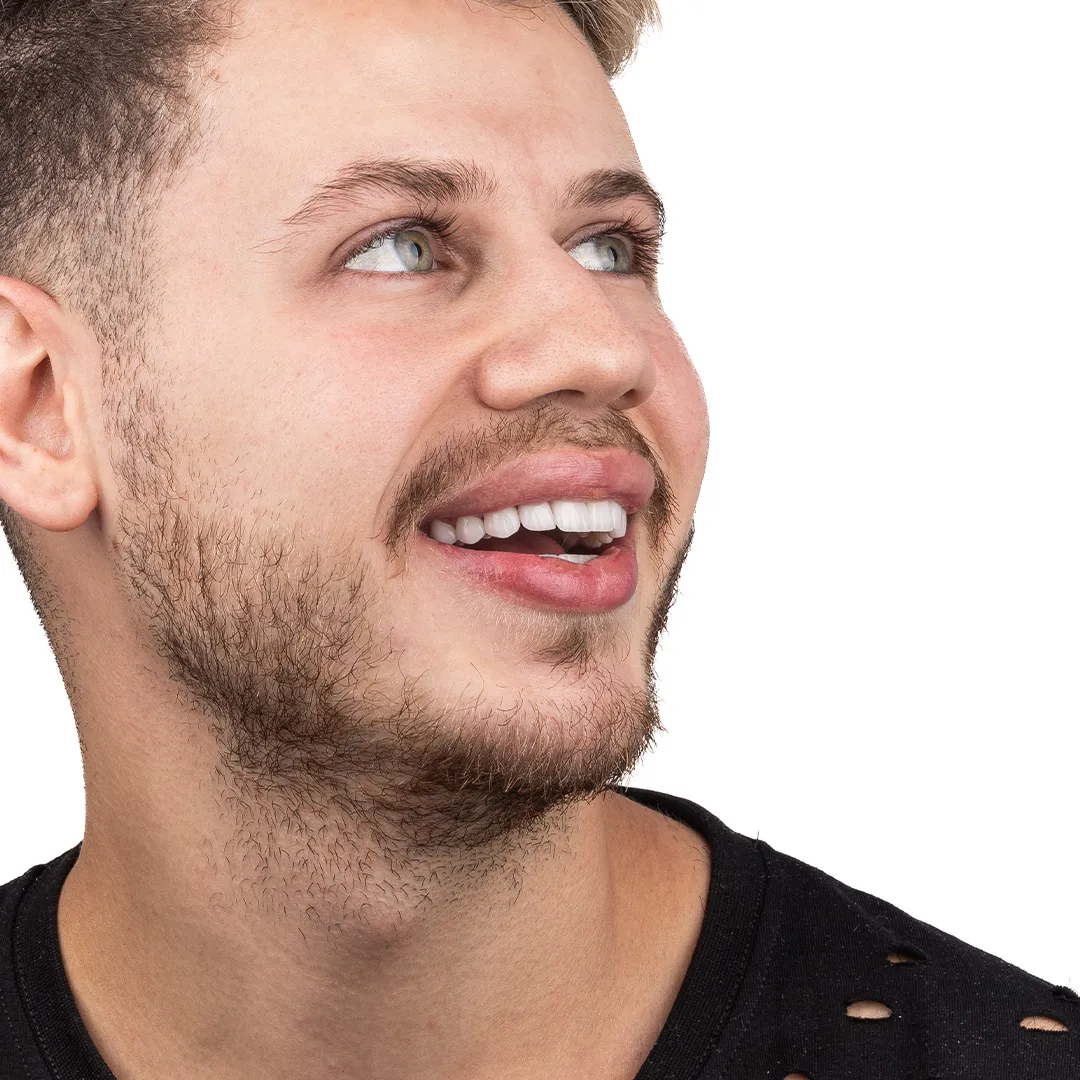 web hollywood smile_11