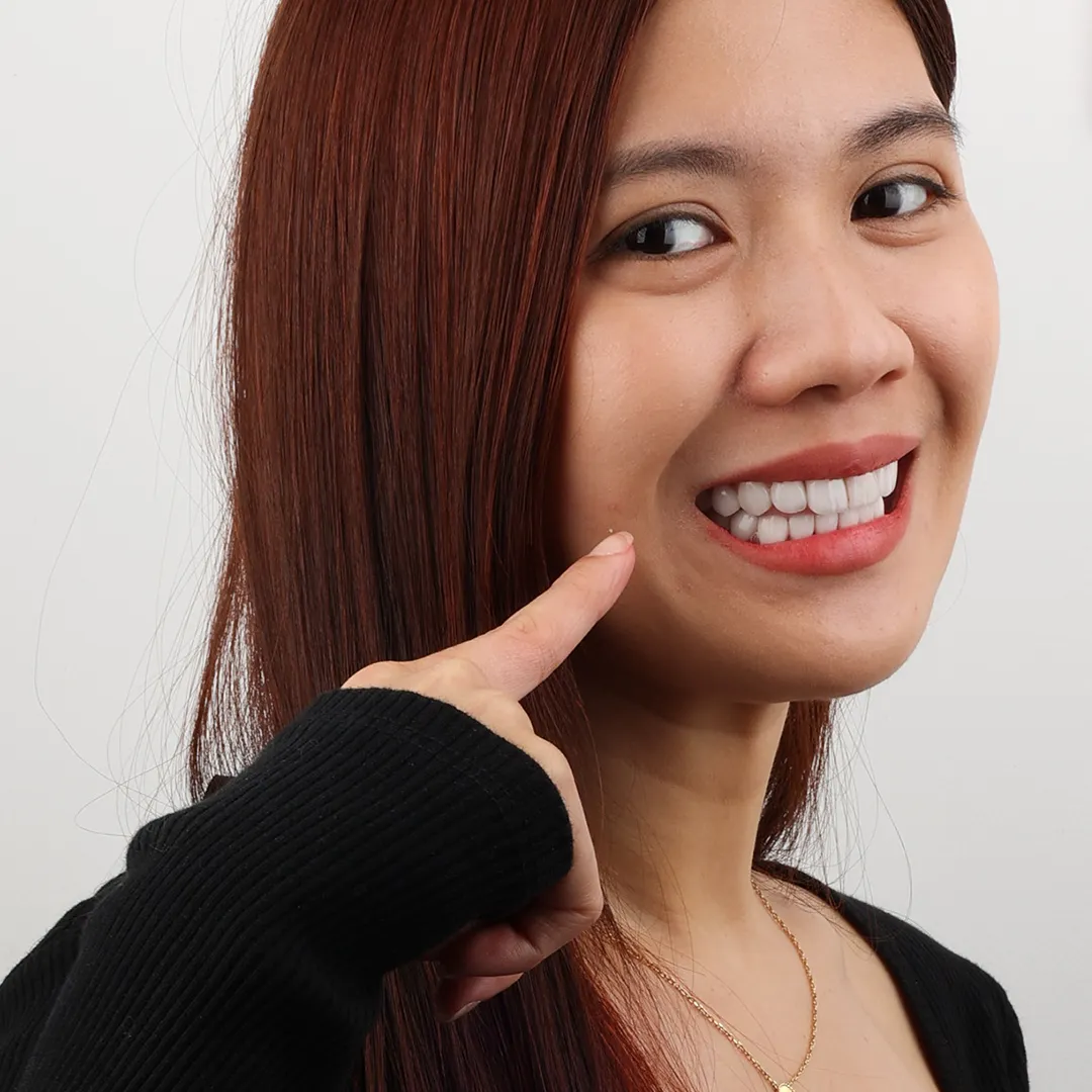 web hollywood smile_6